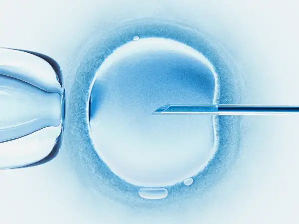 in vitro fertilization