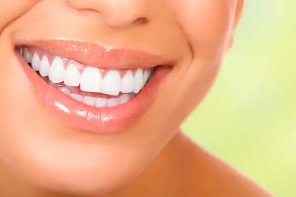 Bottom half of a woman's face smiling brightly with perfectly white, straight teeth