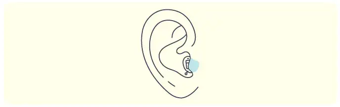 Illustration of completely-in-the-canal hearing aid