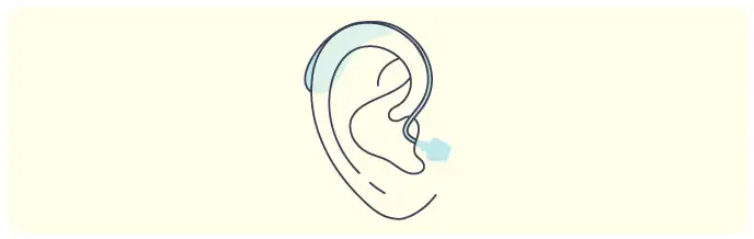 Illustration of receiver-in-canal hearing aid